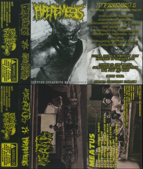 Meatus : Hyperemesis - Meatus